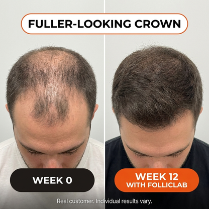 FollicLab Exosome Hairgrowth Serum